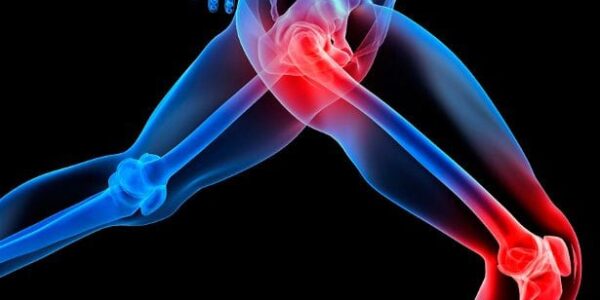 Hip-pain-Sciatica-Leg-pain